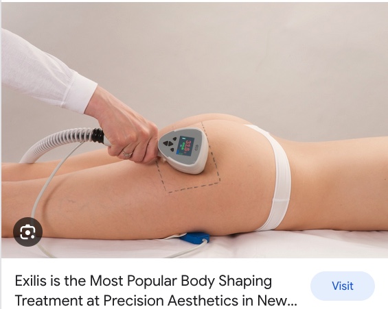 Exilis Body Shaping and skin tightening