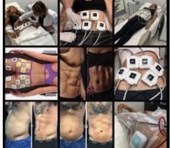 Emsculpt vs Coolsculpt vs True&nbsp;Sculpt