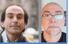 Before and After Thermage